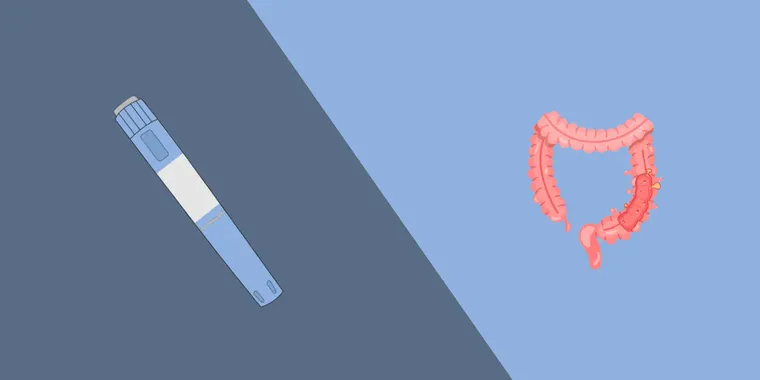 Ozempic and diverticulitis: Risks, side effects, and what you need to know